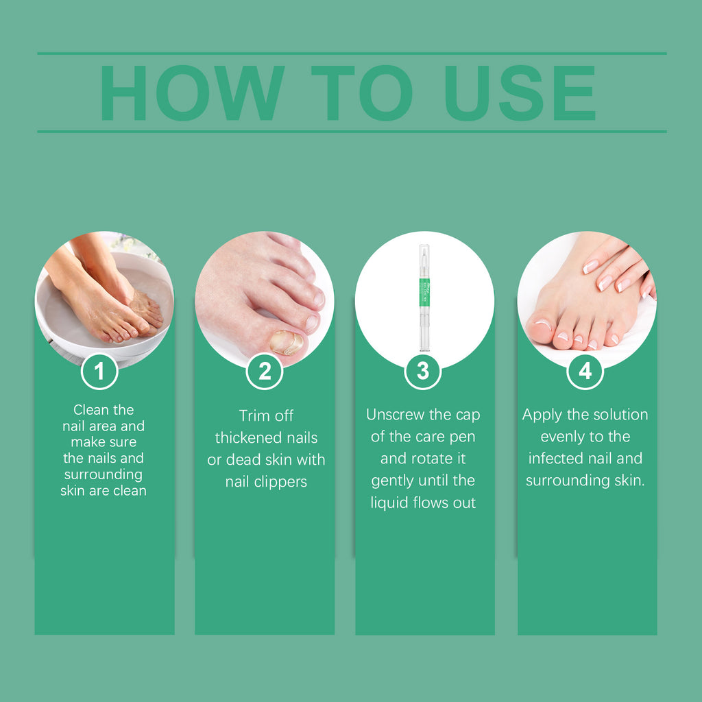 South Moon Nail Repair Pen Moisturizes Gently Repair Hands And Feet Gray Nails Soft Nails Thick Nails Foot Care