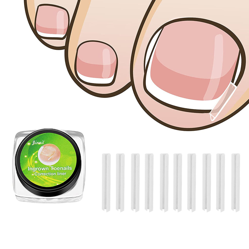Tweezers Nail Trimmer Ingrown Nail Corrector Ingrown Nail Clip Ingrown Nail Tape Ingrown Nail Correction Device