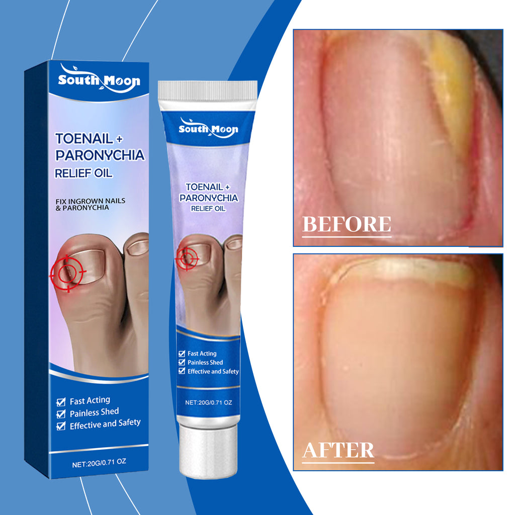 South Moon Nail Care Ointment, Moisturizing And Moisturizing For Nails And Nails